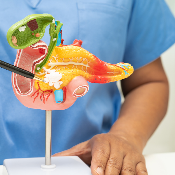 Gallstones & common bile duct stones