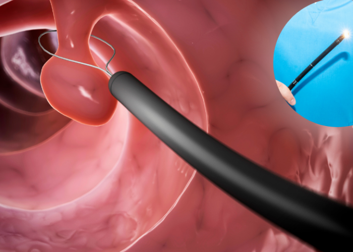 Advanced GI Endoscopy