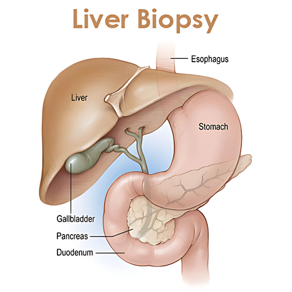 Liver Biopsy